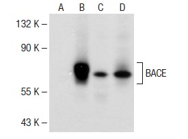 BACE (61-3E7): sc-33711. Western blot analysis of BACE expression in non-transfected 293: sc-110760 (A), human BACE transfected 293: sc-170789 (B), MIA PaCa-2 (C) and SH-SY5Y (D) whole cell lysates.