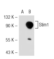 Stim1 (CDN3H4): sc-66173. Western blot analysis of Stim1 expression in non-transfected: sc-117752 (A) and mouse Stim1 transfected: sc-127602 (B) 293T whole cell lysates.