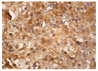 BACE (61-3E7): sc-33711. Immunoperoxidase staining of formalin fixed, paraffin-embedded human adrenal gland tissue showing cytoplasmic staining of glandular cells.