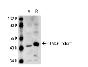 TMC6 (M-220): sc-98494. Western blot analysis of TMC6 expression in non-transfected: sc-117752 (A) and mouse TMC6 transfected: sc-126110 (B) 293T whole cell lysates.