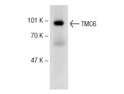 TMC6 (M-220): sc-98494. Western blot analysis of TMC6 expression in mouse liver tissue extract.
