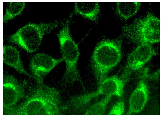 TMC6 (M-220): sc-98494. Immunofluorescence staining of methanol-fixed NIH/3T3 cells showing cytoplasmic localization.