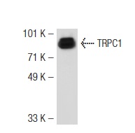 TRPC1 (E-6): sc-133076. Western blot analysis of TRPC1 expression in F9 whole cell lysate.