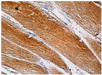 TRPC1 (E-6): sc-133076. Immunoperoxidase staining of formalin fixed, paraffin-embedded human skeletal muscle tissue showing cytoplasmic staining of myocytes.