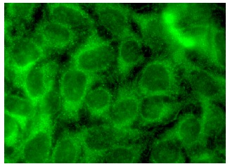 TRPC1 (E-6) sc-133076. Immunofluorescence staining of methanol-fixed HeLa cells showing cytoplasmic localization.