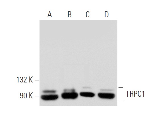 TRPC1 (E-6): sc-133076. Western blot analysis of TRPC1 expression in F9 (A), C4 (B) and U-251-MG (C) whole cell lysates and rat testis (D) and mouse testis (E) tissue extracts.
