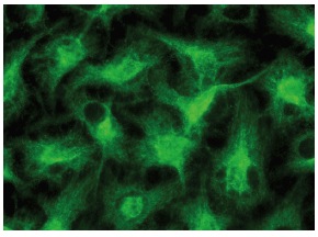 TRPC3/6/7 (H-100): sc-20111. Immunofluorescence staining of methanol-fixed HeLa cells showing membrane localization.