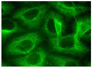 TRPC3/6/7 (H-100): sc-20111. Immunofluorescence staining of methanol-fixed HeLa cells showing cytoplasmic localization.