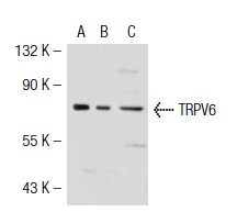 TRPV6 (H-90): sc-28763. Western blot analysis of TRPV6 expression in non-transfected 293T: sc-117752 (A), mouse TRPV6 transfected 293T: sc-124311 (B) and KNRK (C) whole cell lysates.