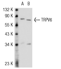 TRPV6 (H-90): sc-28763. Western blot analysis of TRPV6 expression in non-transfected: sc-117752 (A) and human TRPV6 transfected: sc-159059 (B) 293T whole cell lysates.