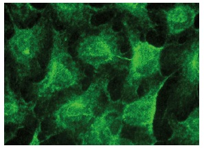 TRPV6 (H-90): sc-28763. Immunofluorescence staining of methanol-fixed HeLa cells showing membrane localization.