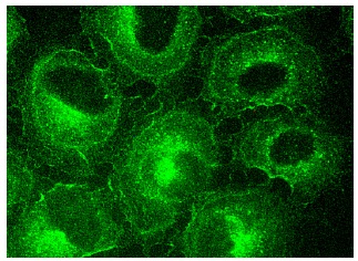 TRPV6 (H-90): sc-28763. Immunofluorescence staining of methanol-fixed HeLa cells showing membrane and cytoplasmic localization.