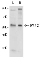 TWIK-2 (P-19): sc-11486. Western blot analysis of TWIK-2 expression in JEG-3 (A) and COLO 320DM (B) whole cell lysates.