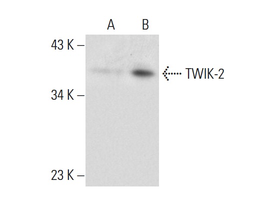 TWIK-2 (P-19): sc-11486. Western blot analysis of TWIK-2 expression in non-transfected: sc-117752 (A) and human TWIK-2 transfected: sc-159075 (B) 293T whole cell lysates.