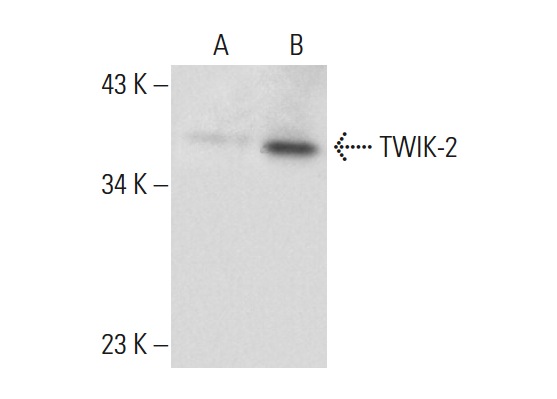 TWIK-2 (P-19): sc-11486. Western blot analysis of TWIK-2 expression in non-transfected: sc-117752 (A) and human TWIK-2 transfected: sc-176433 (B) 293T whole cell lysates.