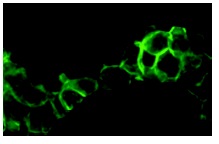 V-ATPase G2 (A-6): sc-25334. Immunofluorescence staining of methanol-fixed SK-N-MC cells showing cytoplasmic and membrane localization.