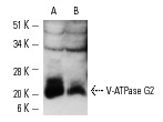V-ATPase G2 (A-6): sc-25334. Western blot analysis of V-ATPase G2 expression in mouse cerebellum (A) and rat brain (B) tissue extracts.