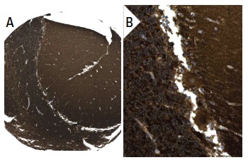 V-ATPase G2 (A-6): sc-25334. Immunoperoxidase staining of formalin fixed, paraffin-embedded human cerebellum tissue showing cytoplasmic staining of cells in granular and molecular layers and Purkinje cells (low and high magnification). Kindly provided by The Swedish Human Protein Atlas (HPA) program.