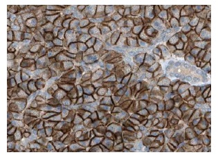 BAM32 (FL-280): sc-67166. Immunoperoxidase staining of formalin fixed, paraffin-embedded human pancreas tissue showing membrane staining of exocrine glandular cells and islets of Langerhans at high magnification. Kindly provided by The Swedish Human Protein Atlas (HPA) program.