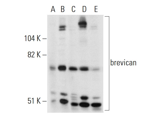 brevican (H-94): sc-292927. Western blot analysis of brevican expression in non-transfected 293T: sc-117752 (A), human brevican transfected 293T: sc-113884 (B), MCF7 (C), HeLa (D) and CCRF-CEM (E) whole cell lysates.