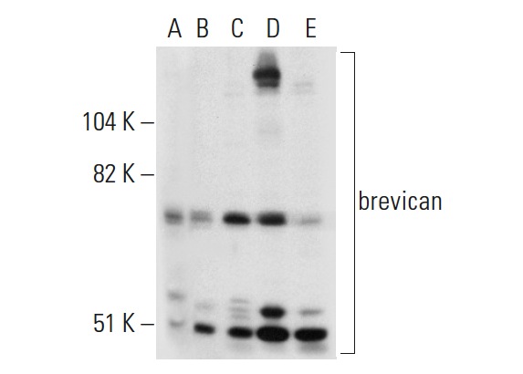 brevican (H-94): sc-292927. Western blot analysis of brevican expression in non-transfected 293T: sc-117752 (A), human brevican transfected 293T: sc-114239 (B), MCF7 (C), HeLa (D) and CCRF-CEM (E) whole cell lysates.