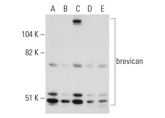 brevican (H-94): sc-292927. Western blot analysis of brevican expression in COLO320DM (A), SH-SY5Y (B), Y79 (C), T98G (D) and U-251-MG (E) whole cell lysates.