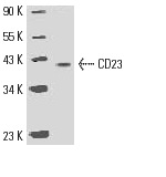 CD23 (C-19): sc-7021. Western blot analysis of CD23 expression in human platelet extract.