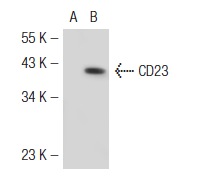CD23 (C-19): sc-7021. Western blot analysis of CD23 expression in non-transfected: sc-117752 (A) and human CD23 transfected: sc-116816 (B) 293T whole cell lysates.