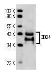 CD24 (SN3): sc-19585. Western blot analysis of CD24 expression in human PBL whole cell lysate.