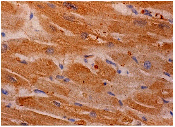 CD36 (SMφ): sc-7309. Immunoperoxidase staining of formalin fixed, paraffin-embedded human heart muscle tissue showing cytoplasmic staining of myocytes.
