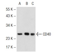 CD40 (N-16): sc-974. Western blot analysis of CD40 expression in non-transfected 293T: sc-117752 (A), human CD40 transfected 293T: sc-174952 (B) and Hela (C) whole cell lysates.