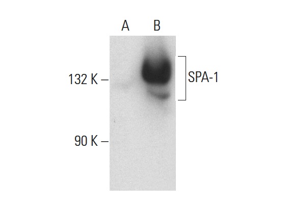 SPA-1 (E-6): sc-166949. Western blot analysis of SPA-1 expression in non-transfected: sc-117752 (A) and human SPA-1 transfected: sc-111824 (B) 293T whole cell lysates.