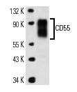 CD55 (NaM16-4D3): sc-51733. Western blot analysis of CD55 expression in HeLa whole cell lysate.