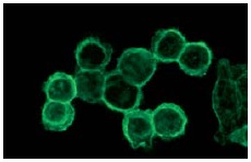 CD55 (NaM16-4D3): sc-51733. Immunofluorescence staining of methanol-fixed HeLa cells showing membrane localization.