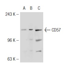 CD57 (NK-1): sc-6261. Western blot analysis of CD57 expression in non-transfected 293T: sc-117752 (A), mouse CD57 transfected 293T: sc-119113 (B) and CCRF-CEM (C) whole cell lysates.