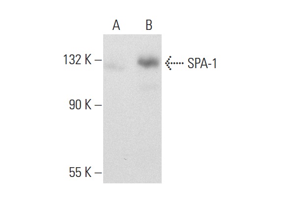 SPA-1 (E-6): sc-166949. Western blot analysis of SPA-1 expression in non-transfected: sc-117752 (A) and mouse SPA-1 transfected: sc-123727 (B) 293T whole cell lysates.