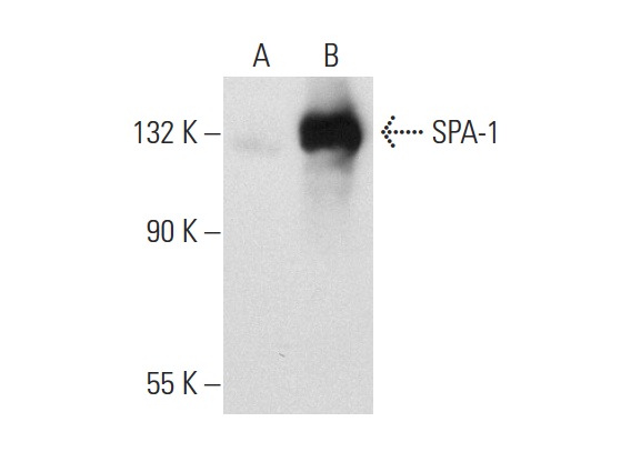 SPA-1 (E-6): sc-166949. Western blot analysis of SPA-1 expression in non-transfected: sc-117752 (A) and human SPA-1 transfected: sc-111824 (B) 293T whole cell lysates.