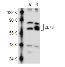 CD73 (H-300): sc-25603. Western blot analysis of CD73 expression in non-transfected: sc-117752 (A) and human CD73 transfected: sc-117055 (B) 293T whole cell lysates.