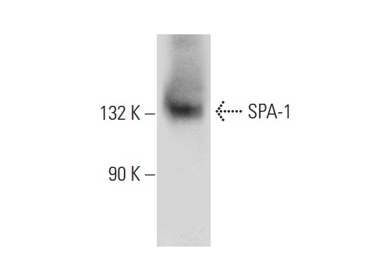 SPA-1 (E-6): sc-166949. Western blot analysis of SPA-1 expression in HeLa whole cell lysate.