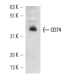 CD74 (M-B741): sc-65272. Western blot analysis of CD74 expression in NAMALWA whole cell lysate.
