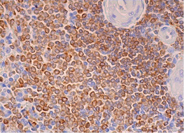 CD74 (M-B741): sc-65272. Immunoperoxidase staining of formalin fixed, paraffin-embedded human spleen tissue showing membrane and cytoplasmic staining of cells in white pulp and cells in red pulp.