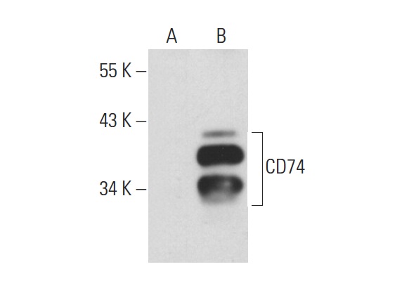 CD74 (LN-2): sc-6262. Western blot analysis of CD74 expression in non-transfected: sc-117752 (A) and human CD74 transfected: sc-175300 (B) 293T whole cell lysates.