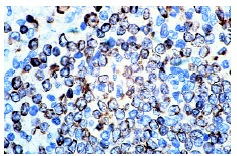 CD74 (LN-2): sc-6262. Immunoperoxidase staining of formalin-fixed, paraffin-embedded normal human spleen showing membrane staining.