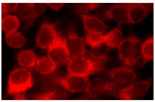 CD8-α (D-9): sc-7970. Immunofluorescence staining of methanol-fixed HeLa cells showing membrane localization.