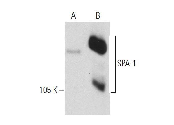 SPA-1 (B-2): sc-166914. Western blot analysis of SPA-1 expression in non-transfected: sc-117752 (A) and mouse SPA-1 transfected: sc-123727 (B) 293T whole cell lysates.