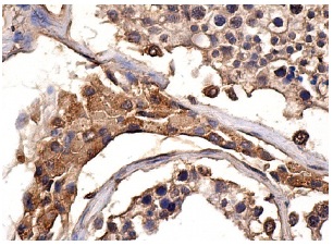 CD83 (F-5): sc-55535. Immunoperoxidase staining of formalin fixed, paraffin-embedded human testis tissue showing membrane staining of cells in seminiferous ducts and cytoplasmic staining of Leydig cells.