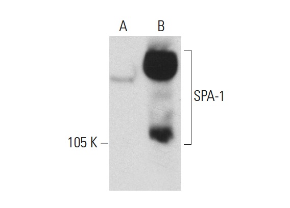 SPA-1 (B-2): sc-166914. Western blot analysis of SPA-1 expression in non-transfected: sc-117752 (A) and human SPA-1 transfected: sc-111824 (B) 293T whole cell lysates.