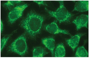 Chitotriosidase (A-11): sc-271460. Immunofluorescence staining of methanol-fixed HeLa cells showing cytoplasmic localization.