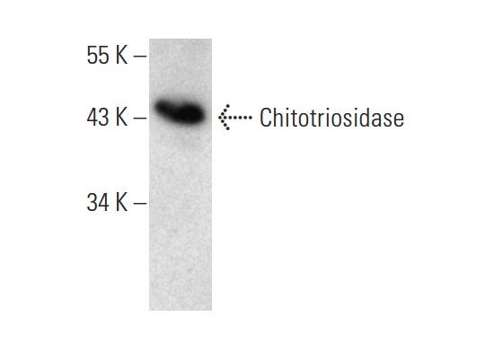 Chitotriosidase (A-3): sc-271282. Western blot analysis of Chitotriosidase expression in AML-193 whole cell lysate.
