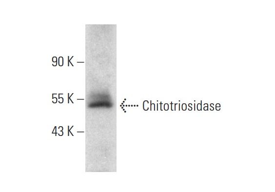 Chitotriosidase (H-66): sc-99033. Western blot analysis of Chitotriosidase expression in AML-193 whole cell lysate.